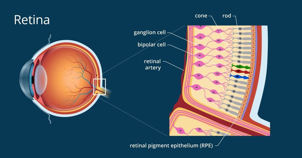 Ablasi Retina Gejala, Penyebab, dan Cara Mengobati